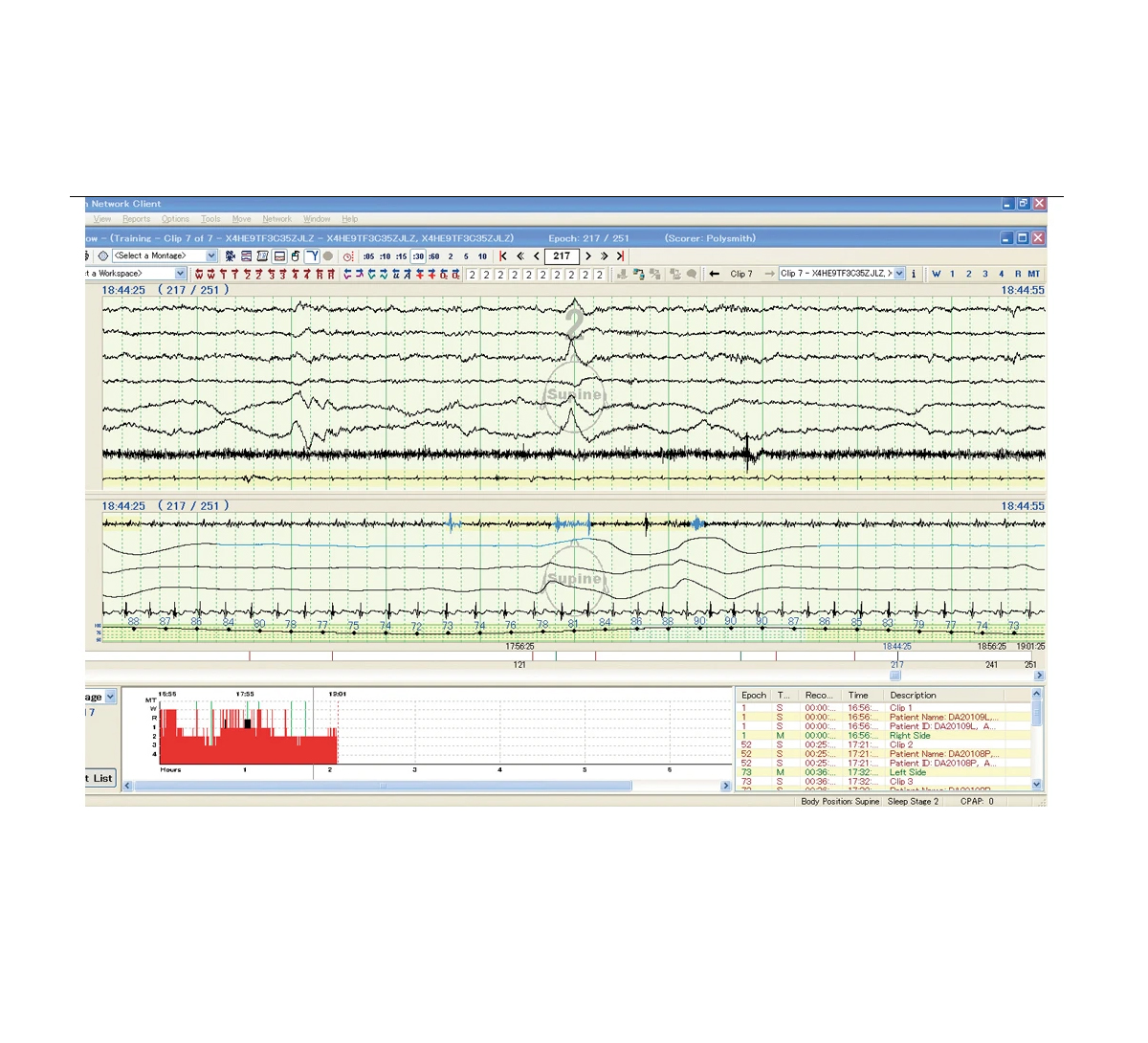 Aparat EEG Neurofax EEG-1200